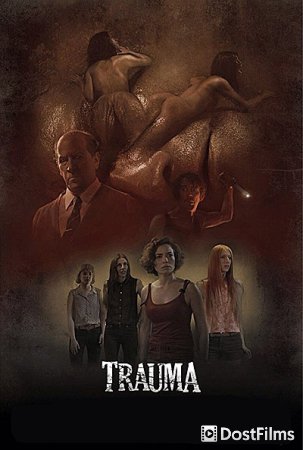 Травма