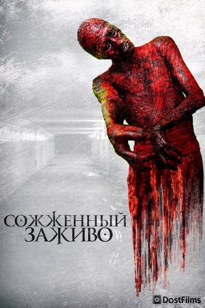 Сожженный заживо